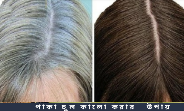 পাকা চুল কালো করার উপায়